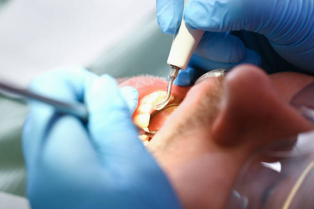 Best Emergency Dental Services for Seniors in Mount Washington, KY