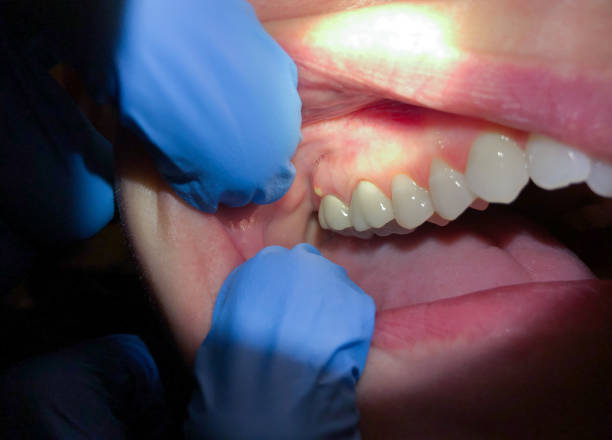Best Weekend Emergency Dentist in Mount Washington, KY